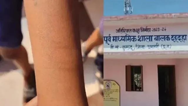 35 Students Allegedly Cut Their Wrists in Dhamtari School, Incident Sparks Panic in Chhattisgarh